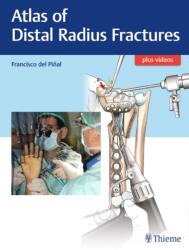 Atlas of Distal Radius Fractures (2018)