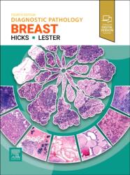 Diagnostic Pathology: Breast (ISBN: 9780443286810)