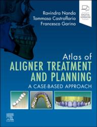 Atlas of Aligner Treatment and Planning - Ravindra Nanda, Tommaso Castroflorio, Francesco Garino, Kenji Ojima (ISBN: 9780443116087)