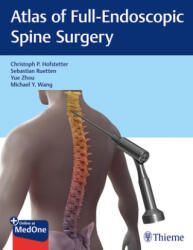 Atlas of Full-Endoscopic Spine Surgery (ISBN: 9781684200238)