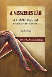 A visszeres láb a visszértágulat megelőzése és gyógyítása (ISBN: 9786156962089)