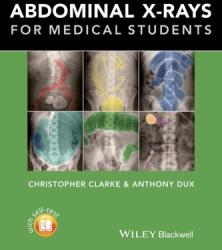 Abdominal X-rays for Medical Students (2015)