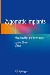 Zygomatic Implants (ISBN: 9783030292638)