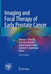 Imaging and Focal Therapy of Early Prostate Cancer (ISBN: 9783031667534)