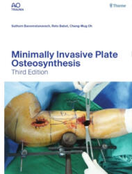 Minimally Invasive Plate Osteosynthesis (ISBN: 9783132454255)