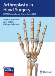 Arthroplasty in Hand Surgery (ISBN: 9783132431744)
