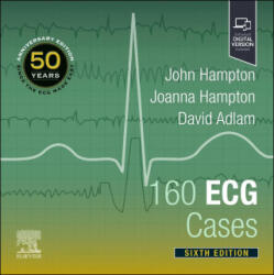 160 ECG Cases - John Hampton, Joanna Hampton, David Adlam (ISBN: 9780323937658)