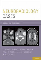 Neuroradiology Cases - Clifford J. Eskey, Clifford J. Belden, David A. Pastel, Arastoo Vossough, Albert J. Yoo (ISBN: 9780199735983)