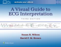 A Visual Guide to ECG Interpretation (2024)
