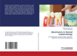 Abutments in Dental Implantology - Avinash V Mehendale (2024)