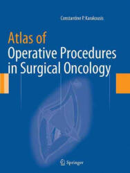 Atlas of Operative Procedures in Surgical Oncology - Constantine P Karakousis (ISBN: 9781493953714)