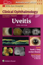 Uveitis (2024)