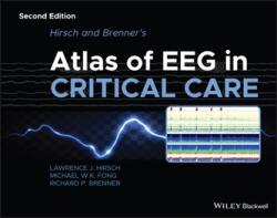 Hirsch and Brenner's Atlas of EEG in Critical Care , 2nd Edition (ISBN: 9781118752890)