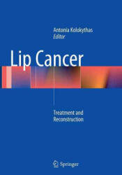 Lip Cancer - Antonia Kolokythas (ISBN: 9783662509326)