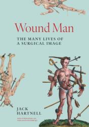 Wound Man - HARTNELL JACK (ISBN: 9780691243481)