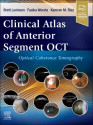 Clinical Atlas of Anterior Segment OCT: Optical Coherence Tomography - Brett Levinson, Fasika Woreta, Kamran M. Riaz (ISBN: 9780443120466)