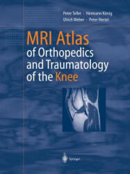 MRI Atlas of Orthopedics and Traumatology of the Knee - Peter Teller, Hermann König, Ulrich Weber, Peter Hertel (ISBN: 9783642628856)