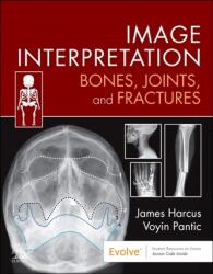 Interpretarea imaginii: Oase, articulații și fracturi (ISBN: 9780323870801)
