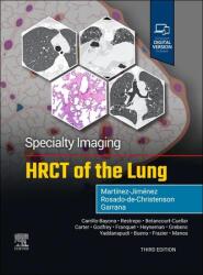 Specialty Imaging: HRCT of the Lung (ISBN: 9780443286360)