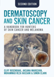 Dermatoscopy and Skin Cancer, second edition - Cliff Rosendahl, Mohammadreza Hassani, Simon Clark (2025)