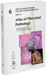 Atlas of Placental Pathology - Drucilla J. Roberts, Carolyn Polizzano (ISBN: 9781933477091)