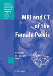MRI and CT of the Female Pelvis - Bernd Hamm, Rosemarie Forstner (ISBN: 9783642060892)