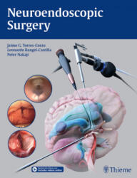 Neuroendoscopic Surgery - Jaime Torres-corzo, Leonardo Rangel-castilla, Peter Nakaji (ISBN: 9781684202218)