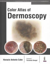 Color Atlas of Dermoscopy - Horacio Cabo (ISBN: 9789386056306)