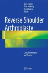 Reverse Shoulder Arthroplasty - Mark Frankle, Scott Marberry, Derek Pupello (ISBN: 9783319208398)