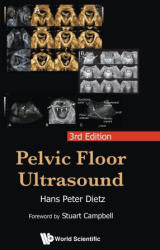 Pelvic Floor Ultrasound: 3rd Edition - DIETZ HANS PETER (ISBN: 9789819815302)