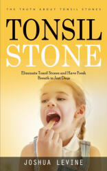 Tonsil Stones - Joshua Levine (ISBN: 9781990373954)