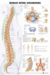 Human Spine Disorders Anatomical Chart - Anatomical Chart Company (ISBN: 9781587794438)