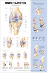 Knee Injuries Anatomical Chart - Anatomical Chart Company (ISBN: 9781587797569)