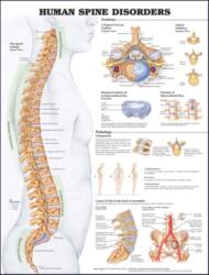 Human Spine Disorders Anatomical Chart - Anatomical Chart Company (ISBN: 9781587793998)