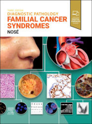 Diagnostic Pathology: Familial Cancer Syndromes - Vania Nosé (ISBN: 9780443286407)