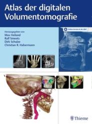 Atlas der digitalen Volumentomografie (ISBN: 9783132007512)