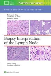 Biopsy Interpretation of the Lymph Node (ISBN: 9781975184629)