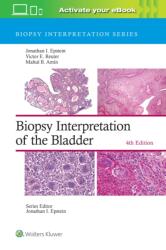 Biopsy Interpretation of the Bladder (ISBN: 9781975199203)