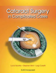 Cataract Surgery in Complicated Cases - Luigi Caretti (2013)