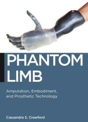 Phantom Limb: Amputation Embodiment and Prosthetic Technology (2014)