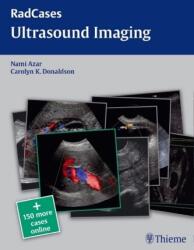 Radcases Ultrasound Imaging - Nami R. Azar, Carolyn Donaldson (ISBN: 9781604063226)
