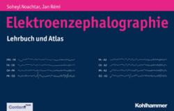 Elektroenzephalographie (ISBN: 9783170214347)