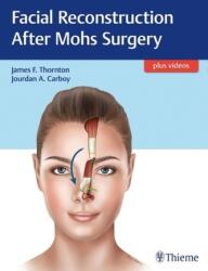 Facial Reconstruction After Mohs Surgery - James F. Thornton (ISBN: 9781626237346)