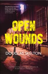 Open Wounds (ISBN: 9781910745335)