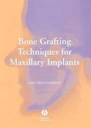 Bone Grafting Techniques for Maxillary Implants - Karl-Erik Kahnberg (2005)