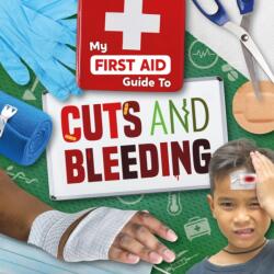 Cuts and Bleeding (ISBN: 9781786378361)