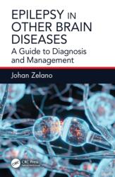 Epilepsy in Other Brain Diseases (ISBN: 9781032815213)