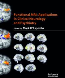 Functional MRI (ISBN: 9781842142950)