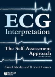 ECG Interpretation (ISBN: 9781405167499)