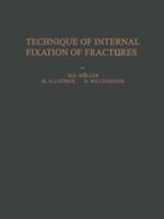 Technique of Internal Fixation of Fractures (2012)